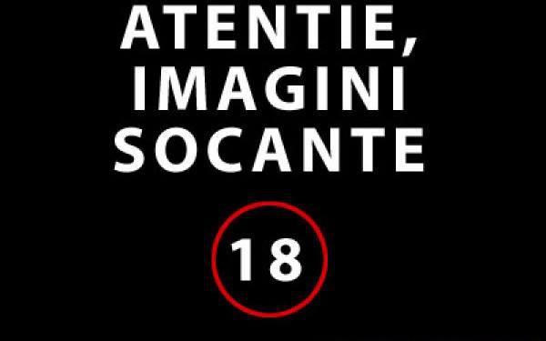 Atentie,imagini socante +18 - 2481306164926216972151078305491n.jpg